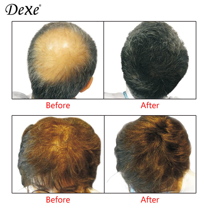 Remplacement visuel Fibre capillaire Poudre Amincissement des cheveux Sèche  Poudre de remplissage Poudre de cheveux dense d'âge moyen